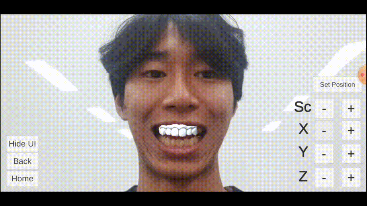 DentureAR